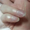 小指と薬指の爪の白点