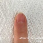 人差し指の爪の黒点